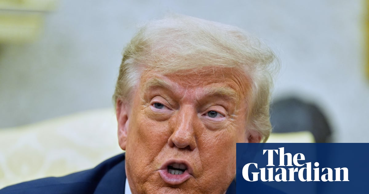 What is chronic venous insufficiency, the condition Trump was diagnosed with?