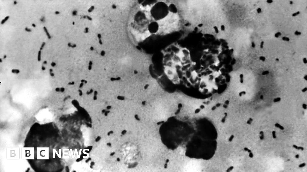 Arizona resident dies from plague, health officials say