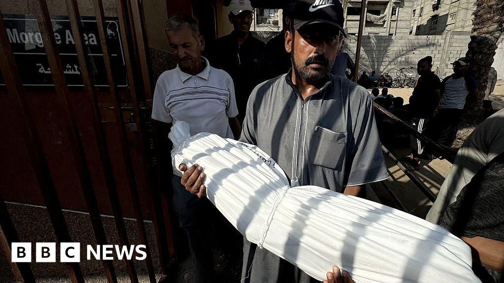 Gaza health and wellness ministry claims 33 individuals passed away from poor nutrition in 2 days