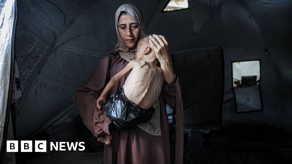 Gazans 'wasting away' as mass starvation spreads, humanitarian groups warn