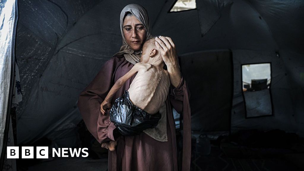 The tale behind the picture of a depriving Gaza child